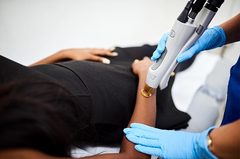 Laser Hair Removal
