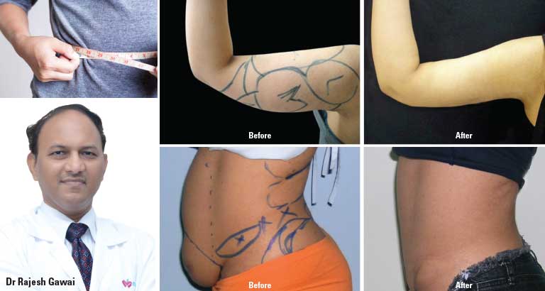 Achieve a Positive Body Image