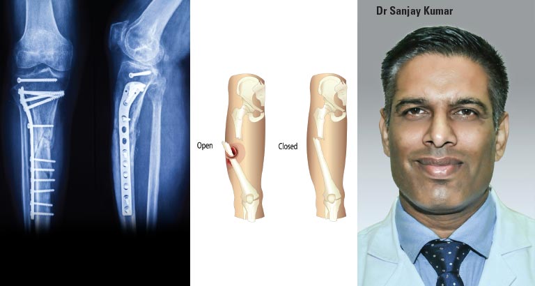 Treating a Surgical Emergency - Bahrain Specialist Hospital