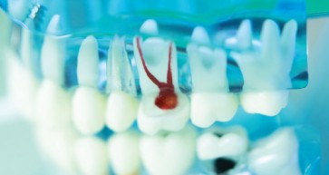 The Tooth Saver - Bahrain Specialist Hospital