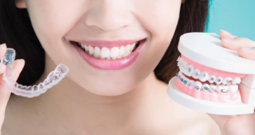 Orthodontic Treatment