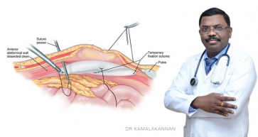 Laparoscopy For The Elderly